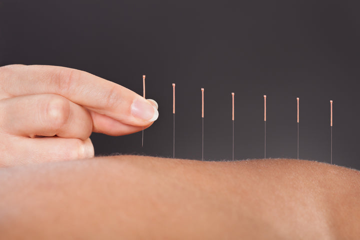 files/bigstock-Acupuncture-Treatment-63623578.jpg